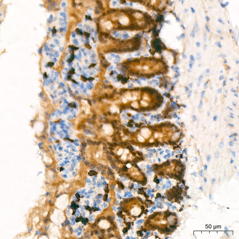 Immunohistochemistry - Anti-CDX2 Antibody (A93194) - Antibodies.com