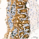 Immunohistochemistry - Anti-CDX2 Antibody (A93194) - Antibodies.com