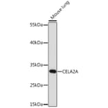 Western Blot - Anti-CELA2A Antibody (A93195) - Antibodies.com