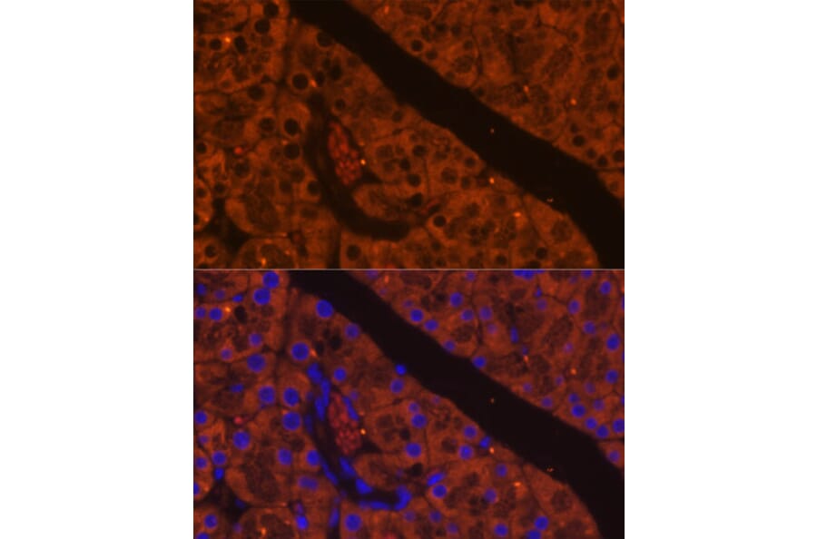 Immunofluorescence - Anti-CELA2A Antibody (A93195) - Antibodies.com