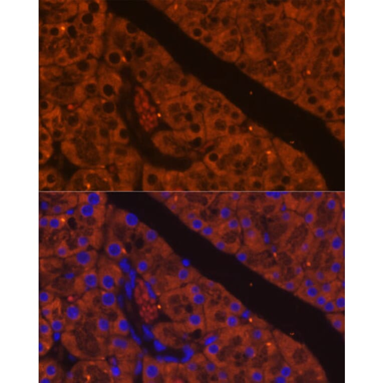 Immunofluorescence - Anti-CELA2A Antibody (A93195) - Antibodies.com