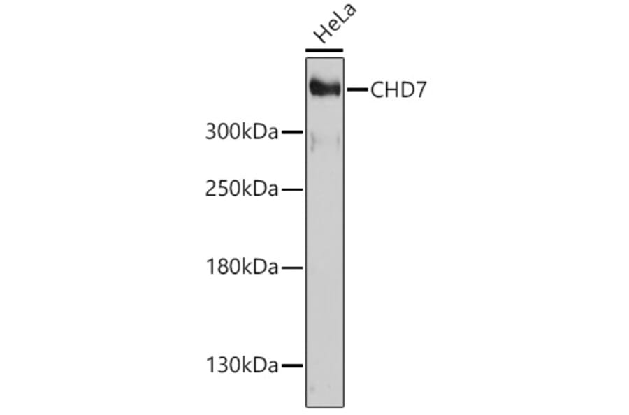 Western Blot - Anti-Chd7 Antibody (A93196) - Antibodies.com