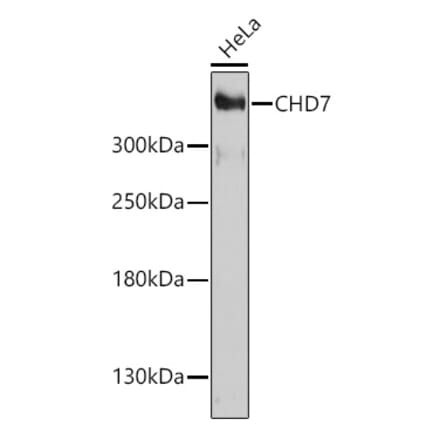 Western Blot - Anti-Chd7 Antibody (A93196) - Antibodies.com