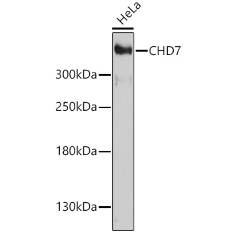 Western Blot - Anti-Chd7 Antibody (A93196) - Antibodies.com