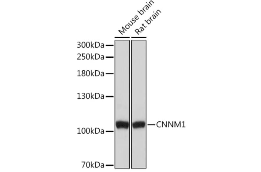 Western Blot - Anti-CNNM1 Antibody (A93198) - Antibodies.com
