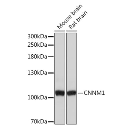 Western Blot - Anti-CNNM1 Antibody (A93198) - Antibodies.com