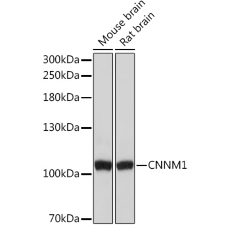 Western Blot - Anti-CNNM1 Antibody (A93198) - Antibodies.com