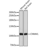 Western Blot - Anti-CNNM1 Antibody (A93198) - Antibodies.com