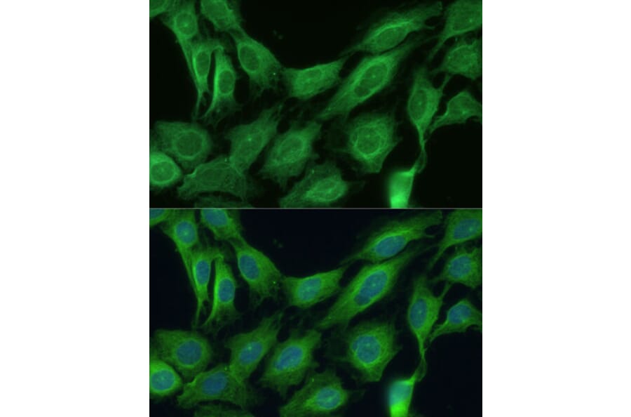 Immunofluorescence - Anti-CNNM1 Antibody (A93198) - Antibodies.com