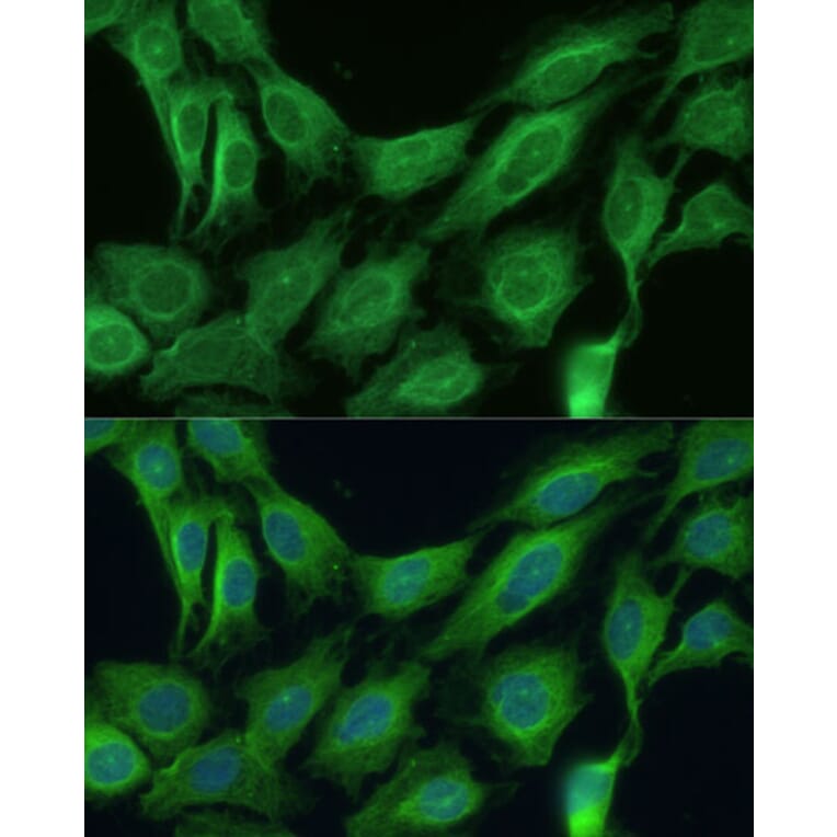 Immunofluorescence - Anti-CNNM1 Antibody (A93198) - Antibodies.com