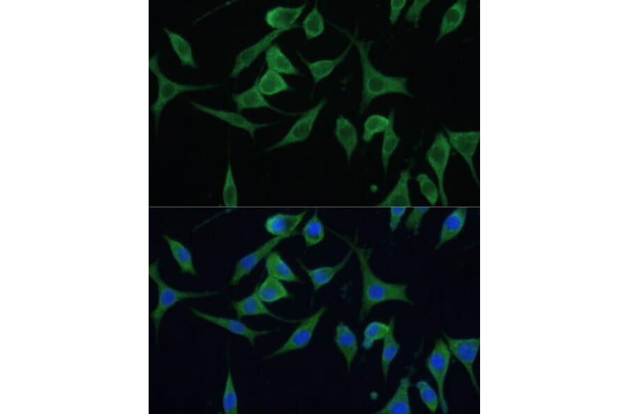 Immunofluorescence - Anti-CNNM1 Antibody (A93198) - Antibodies.com