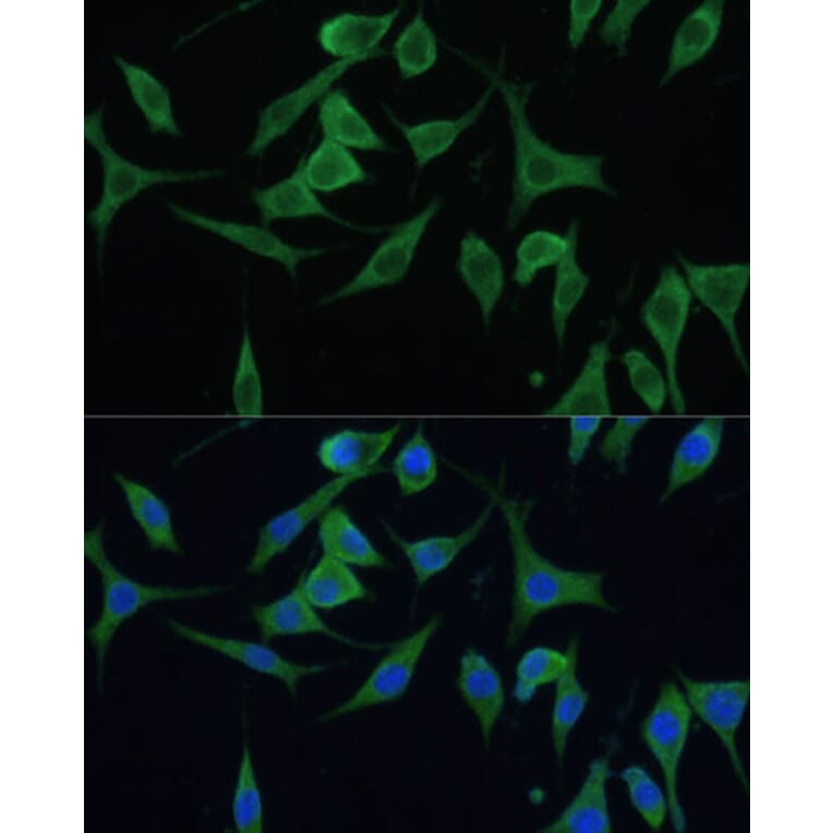 Immunofluorescence - Anti-CNNM1 Antibody (A93198) - Antibodies.com