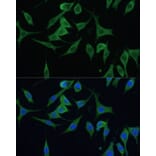 Immunofluorescence - Anti-CNNM1 Antibody (A93198) - Antibodies.com