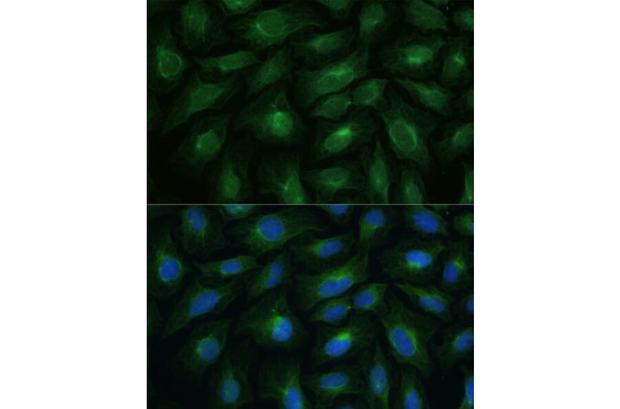 Immunofluorescence - Anti-CNNM1 Antibody (A93198) - Antibodies.com