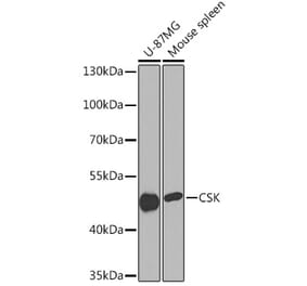 Western Blot - Anti-CSK Antibody (A93202) - Antibodies.com