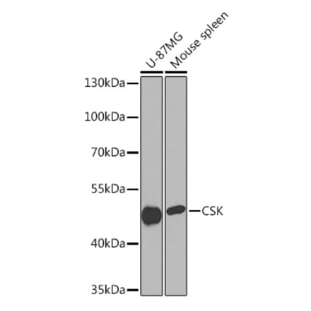 Western Blot - Anti-CSK Antibody (A93202) - Antibodies.com