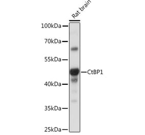 Western Blot - Anti-CtBP1 Antibody (A93203) - Antibodies.com