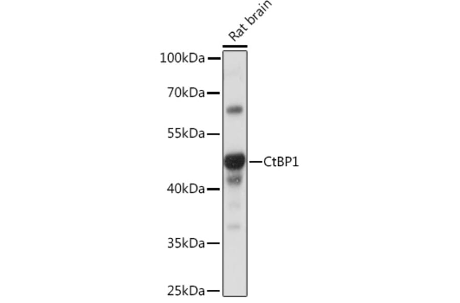 Western Blot - Anti-CtBP1 Antibody (A93203) - Antibodies.com