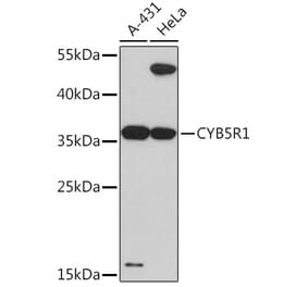 Western Blot - Anti-CYB5R1 Antibody (A93204) - Antibodies.com