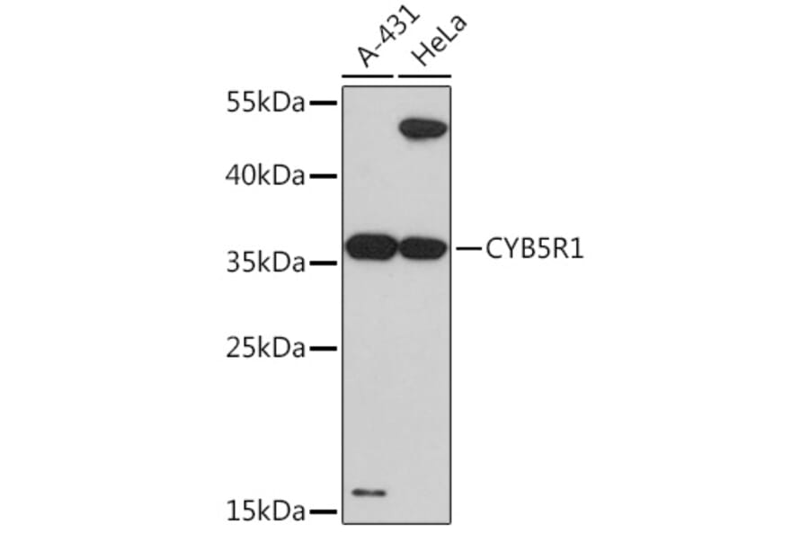 Western Blot - Anti-CYB5R1 Antibody (A93204) - Antibodies.com