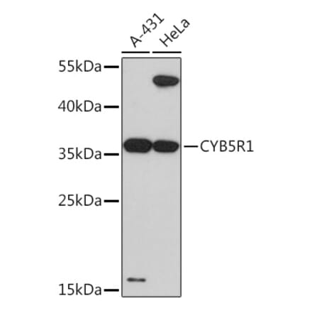 Western Blot - Anti-CYB5R1 Antibody (A93204) - Antibodies.com