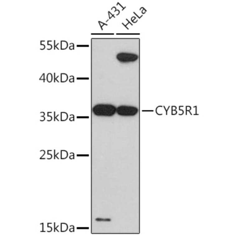 Western Blot - Anti-CYB5R1 Antibody (A93204) - Antibodies.com