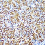 Immunohistochemistry - Anti-CYB5R1 Antibody (A93204) - Antibodies.com