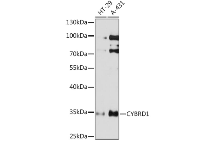 Western Blot - Anti-Cytochrome b reductase 1/DCYTB Antibody (A93205) - Antibodies.com