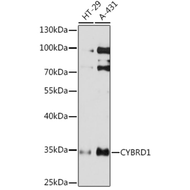 Western Blot - Anti-Cytochrome b reductase 1/DCYTB Antibody (A93205) - Antibodies.com
