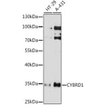 Western Blot - Anti-Cytochrome b reductase 1/DCYTB Antibody (A93205) - Antibodies.com