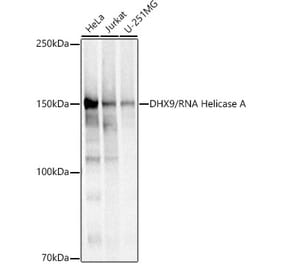 Western Blot - Anti-RNA Helicase A Antibody (A93209) - Antibodies.com