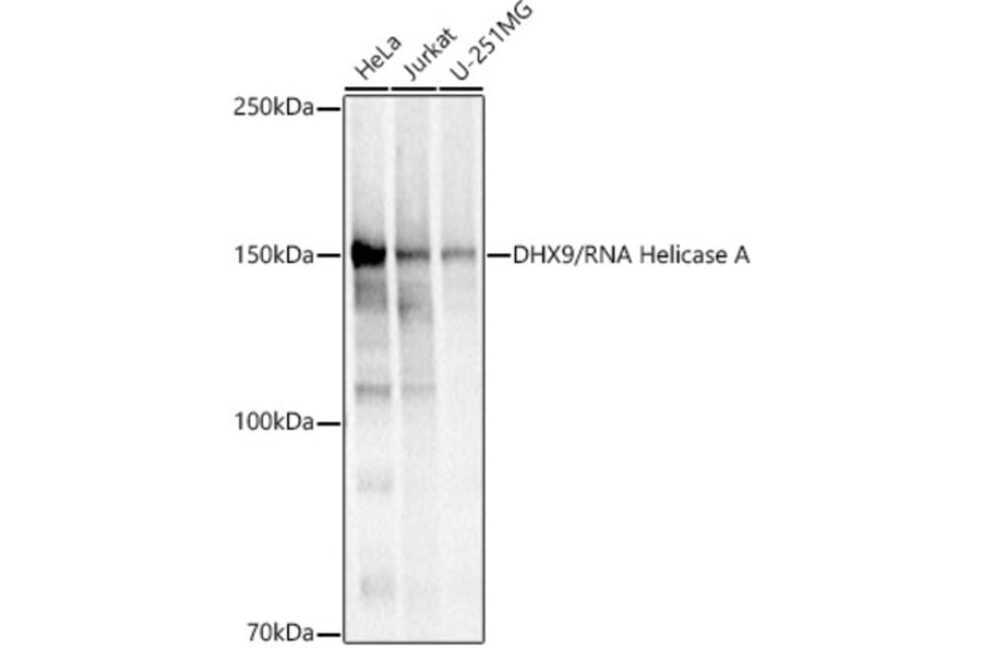 Western Blot - Anti-RNA Helicase A Antibody (A93209) - Antibodies.com