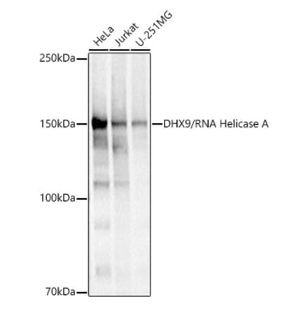 Western Blot - Anti-RNA Helicase A Antibody (A93209) - Antibodies.com