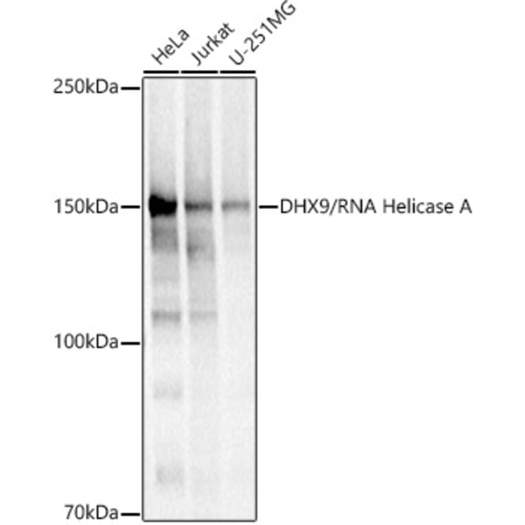 Western Blot - Anti-RNA Helicase A Antibody (A93209) - Antibodies.com
