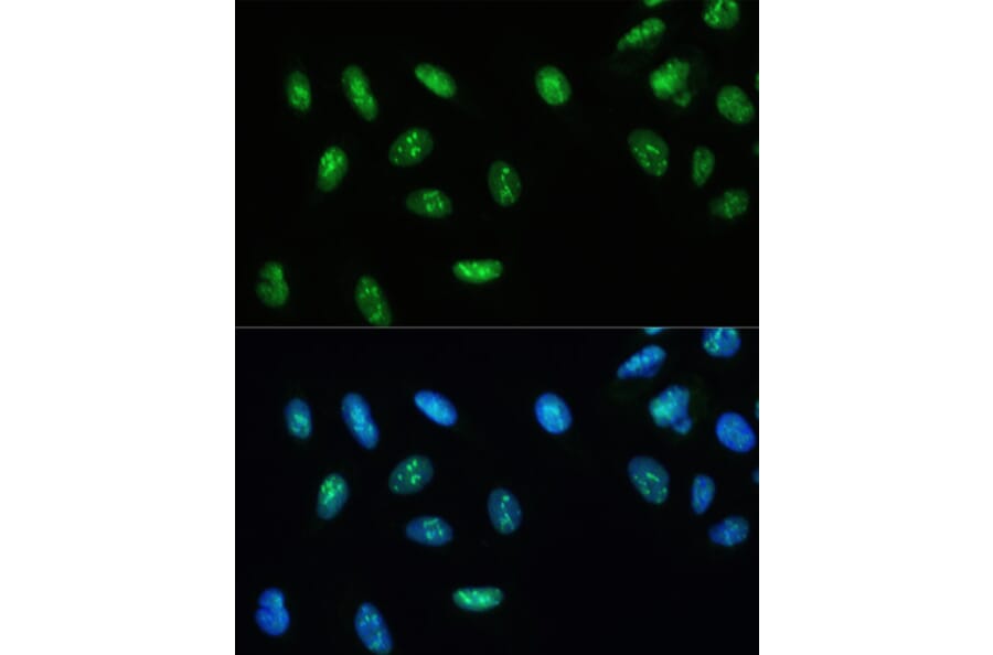 Immunofluorescence - Anti-RNA Helicase A Antibody (A93209) - Antibodies.com