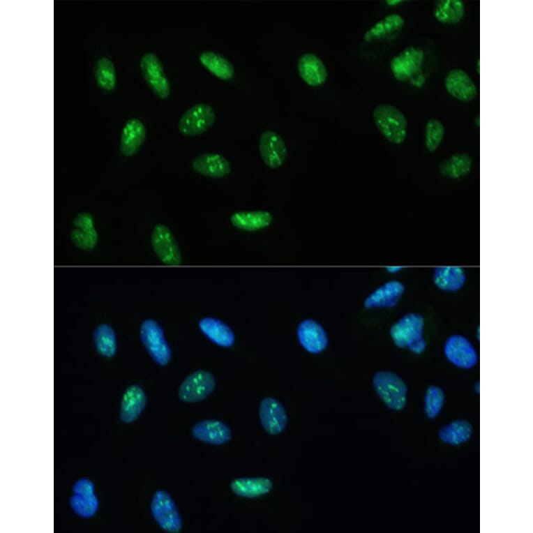 Immunofluorescence - Anti-RNA Helicase A Antibody (A93209) - Antibodies.com