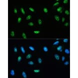 Immunofluorescence - Anti-RNA Helicase A Antibody (A93209) - Antibodies.com