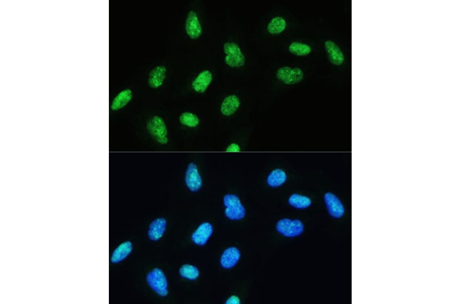 Immunofluorescence - Anti-RNA Helicase A Antibody (A93209) - Antibodies.com