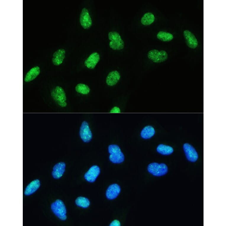 Immunofluorescence - Anti-RNA Helicase A Antibody (A93209) - Antibodies.com