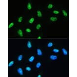 Immunofluorescence - Anti-RNA Helicase A Antibody (A93209) - Antibodies.com