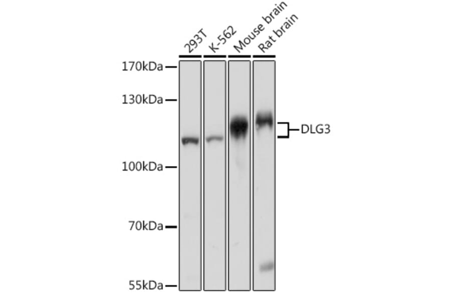 Western Blot - Anti-SAP102 Antibody (A93210) - Antibodies.com