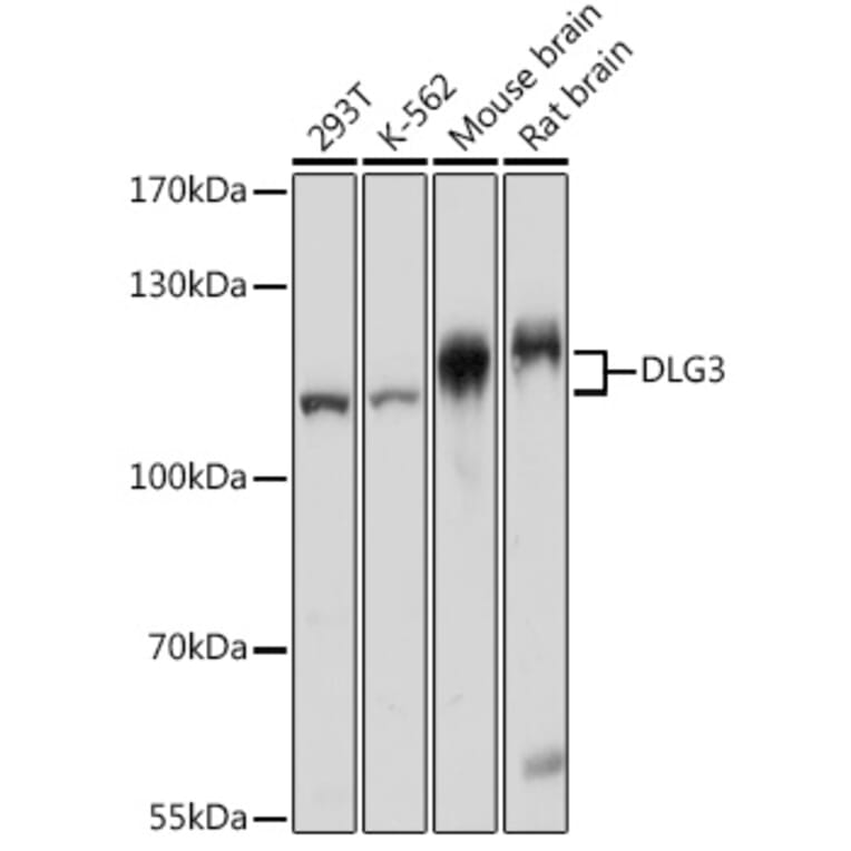 Western Blot - Anti-SAP102 Antibody (A93210) - Antibodies.com