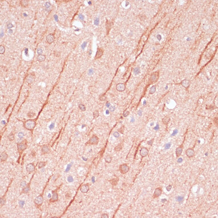 Immunohistochemistry - Anti-SAP102 Antibody (A93210) - Antibodies.com