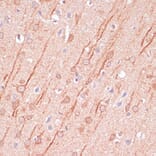 Immunohistochemistry - Anti-SAP102 Antibody (A93210) - Antibodies.com
