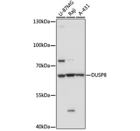 Western Blot - Anti-DUSP8 Antibody (A93212) - Antibodies.com