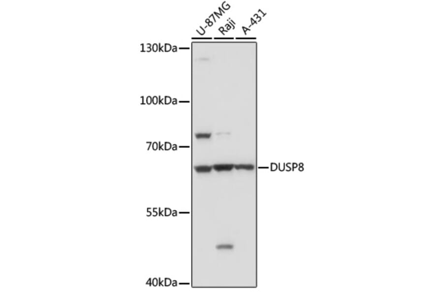 Western Blot - Anti-DUSP8 Antibody (A93212) - Antibodies.com
