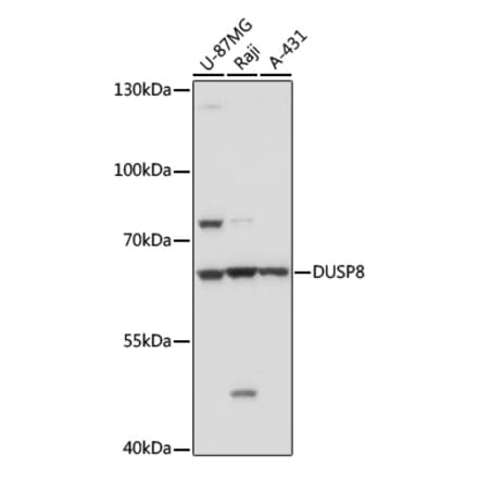 Western Blot - Anti-DUSP8 Antibody (A93212) - Antibodies.com