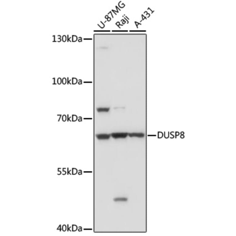Western Blot - Anti-DUSP8 Antibody (A93212) - Antibodies.com