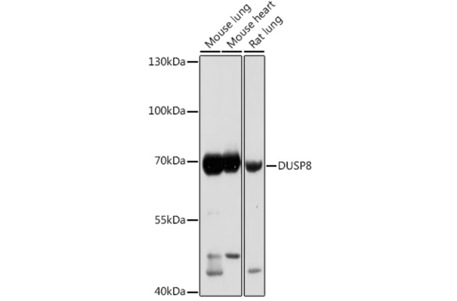 Western Blot - Anti-DUSP8 Antibody (A93212) - Antibodies.com