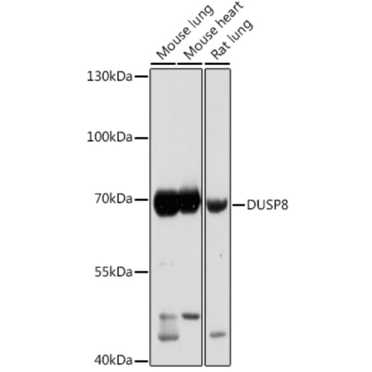 Western Blot - Anti-DUSP8 Antibody (A93212) - Antibodies.com
